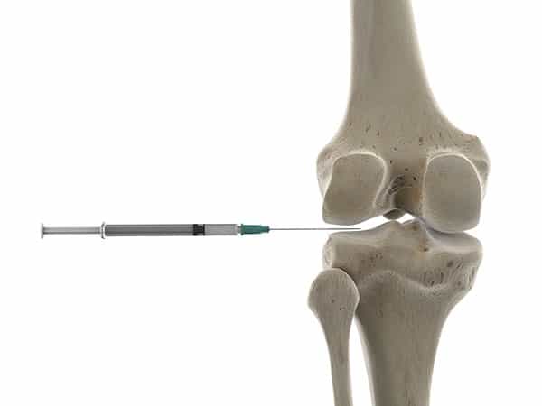 Knee injection for joint pain