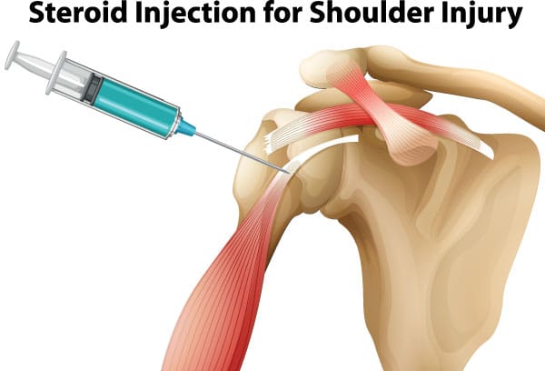 Shoulder Injection for shoulder injury